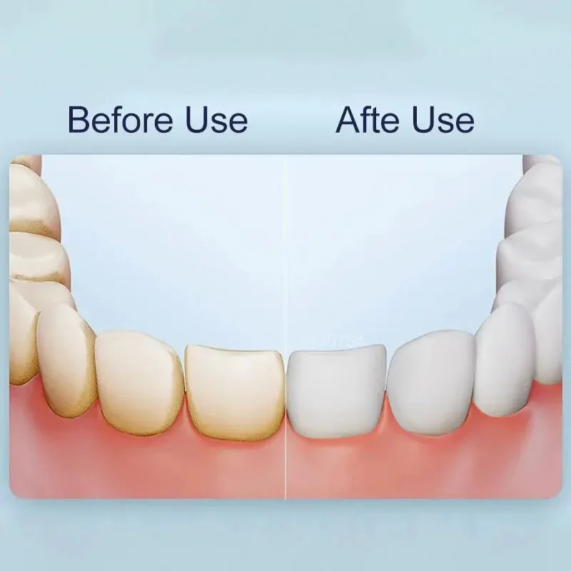 Irrigador Oral Compacto com Tecnologia de Jato de Água