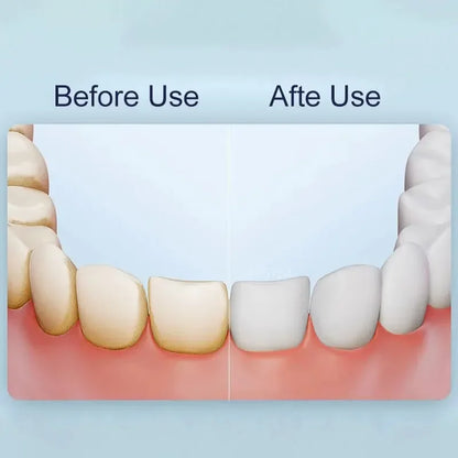 Irrigador Oral Compacto com Tecnologia de Jato de Água